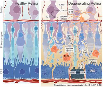 IL-1 Family Members Mediate Cell Death, Inflammation and Angiogenesis in Retinal Degenerative Diseases